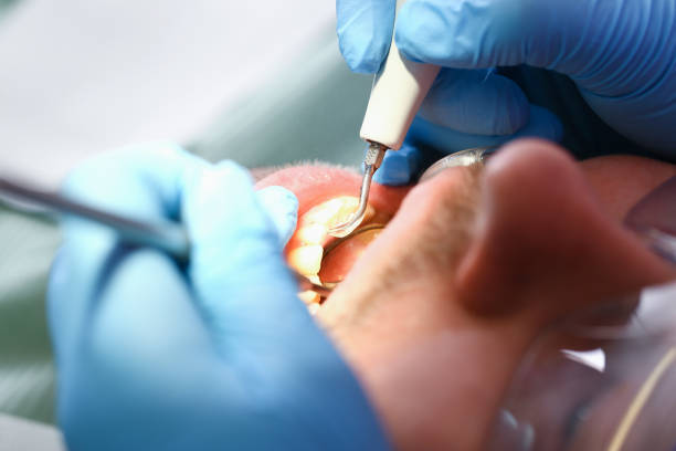 Best Emergency Dentist for Lost Fillings or Crowns in Nicoma Park, OK